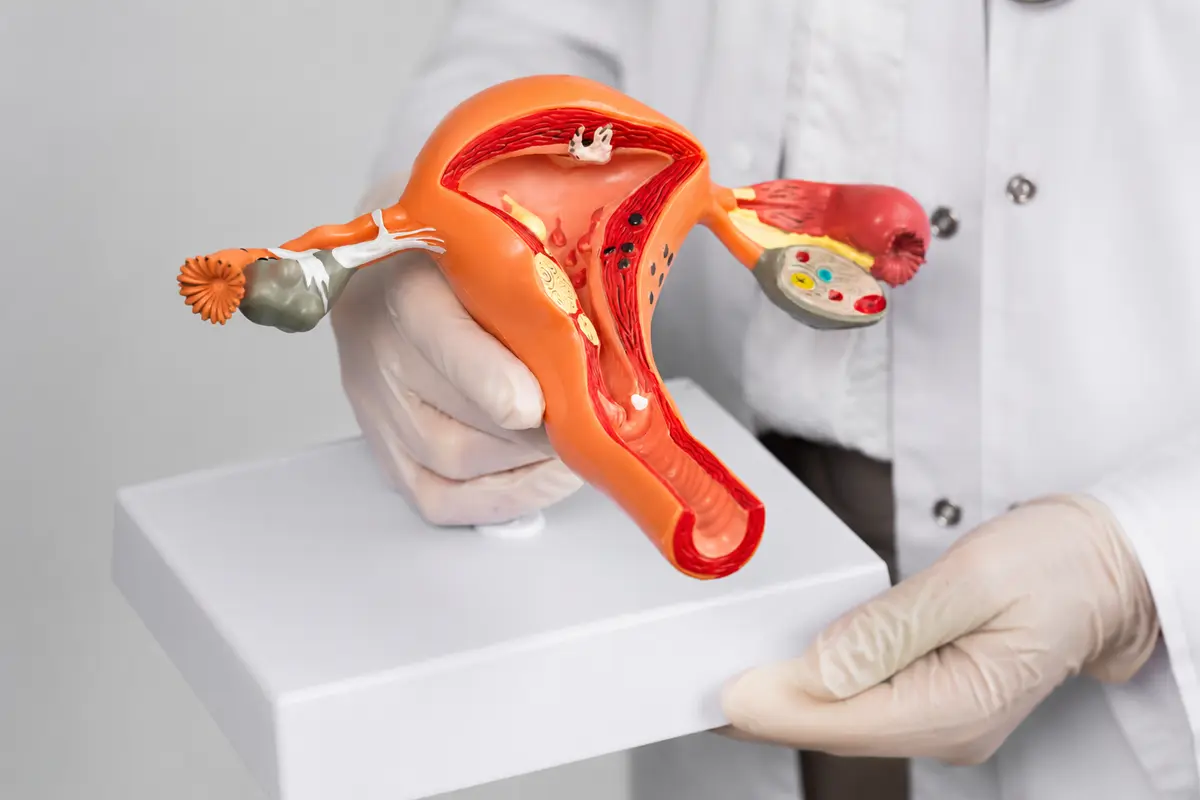 Heavy Periods Treatment London